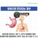 헬리코박터균 원인 음성 양성 전염 이미지