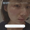 얼라이브피부과의원 | 압구정 루나의원 예약, 루비레이저 가격 및 후기
