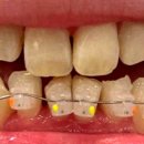 에버스마일치과교정과치과의원 이미지