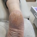 네일글림
