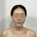 구미 상모동 미백피부관리 수분충전마사지 &lt;혜늘뷰티&gt;