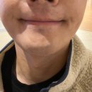 유앤아이의원 | 동탄 유앤아이의원 3회차 방문 후기 남성 젠틀맥스 제모, 흑자 레이저 리얼 후기