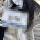 햇님약국 | 강남 ㅇㅇㅅ 안과 투데이라섹 리얼후기- 당일~일주일차(회복경과)