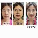 이뮤셀의원 이미지