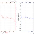 상무보청기 이미지