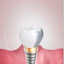 오산미소치과의원 이미지