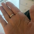 군산치과 | 군산 조촌동0000치과(망한 교정후기)