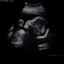 세상의반여성의원 이미지