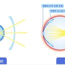 밝은눈안경 이미지