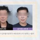 리팅대구