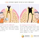 서울테라치과 이미지