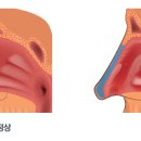 경희로움한의원 네이버블로그