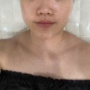 테헤란로202 | 선릉피부관리 리로브 스킨앤바디에서 얼굴 윤곽리프팅 스칼프팅 받은 후기