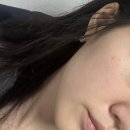 미백한약 잡티개선에 효과 있는 사상참경희한의원 클레어 펄화이트 솔직후기