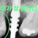 이하루치과 이미지