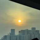 발목인대봉합술 3주차 후기