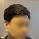 다다 다모아 | 남자앞머리가발 성공적인 착용 후기