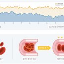 템프업플러스 | 건강과 일상이 달라지는 템프업 기능강화팬티