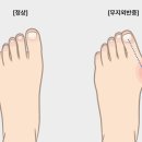석바위신발