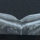 우안과의원 이미지