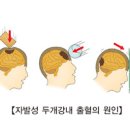 구음장애 dysarthria 조음장애 원인 및 간호 알아보겠습니다. 이미지