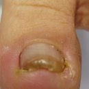 레푸스 감삼점&에이레네 이미지