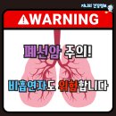 휴엔병원 | 폐선암 비흡연자도 위험합니다! 소세포암과 다른 점