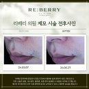 수원제모피부과에서 깔끔한 인상 시작해보세요 (feat. 영구제모)