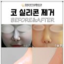 청담코지의원 네이버블로그