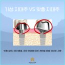 맞춤주