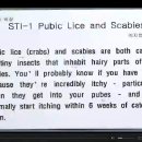 STI-1 Pubic Lice and Scabies 이미지