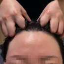 웰킨두피탈모센터 부평점 | 인천 부평 웰킨두피탈모센터 부평점 두피 관리 후기