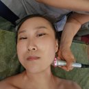 호평동피부관리 예뻐지는날 물방울 초음파관리 후기