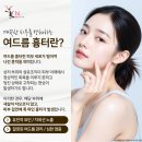 광주서구피부과 여드름 흉터 포텐자로 깔끔하게
