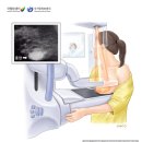 미사치유외과의원 | 미사치유외과 :: 20대 여성 맘모톰 수술 후기