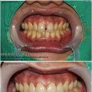 모양치과기공소 이미지