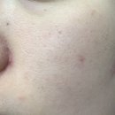 예뷰티스킨케어 | 바이오아 TPDRN 에센스 티들샷으로 스킨케어한 후기