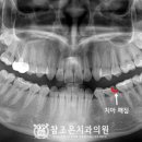 조은아이치과 네이버블로그