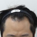 압구정맘모스헤어라인의원 이미지