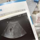 이화더블유산부인과 티스토리