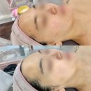 씨유 목동12단지점 | [목동 피부관리 맛집]올가드림뷰티 목동신정점 내돈내산 찐후기_2