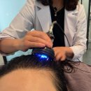 [닥터모락 송도점] 연수구 송도 탈모관리 || 송도 두피 케어 || 송도 탈모 관리|| 송도 두피 케어