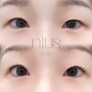 니어스 아이래쉬