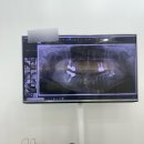 원주) 서울매일치과/ 무실동 치과/ 치과치료 가격/ 스케일링/