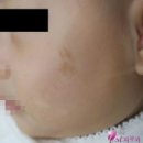 세종퍼스트피부과 이미지