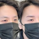 링링브로우 이미지