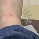 365백세부부한의원 이미지