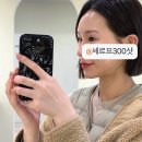 300 | 창원 피부과 세르프 리프팅 300샷 후기 : 세르프 효과 통증 전후 비교 사진 등등