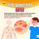 알레르기 이미지