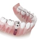 미소탑의원 이미지